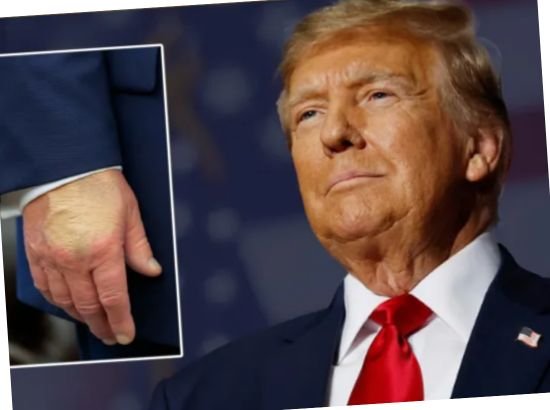 Hand Of Trump